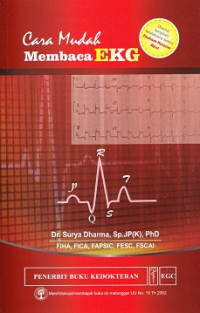 Image of Cara mudah membaca EKG